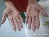 Ngủ ngon, ít ốm đau ... họ có nhiều cơn gió nhờ hấp thụ hydro!